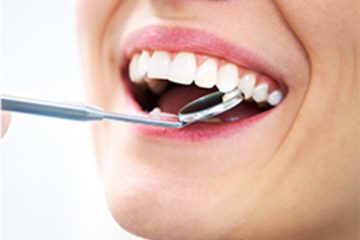 השתלת שיניים בלסת העליונה