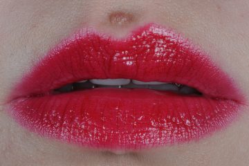 מהם הפרמטרים העיקריים שמשפיעים על מחיר טיפול השתלת שיניים?